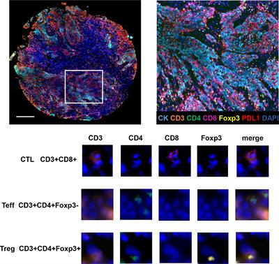 Frontiers | Spatial architecture of regulatory T-cells correlates 